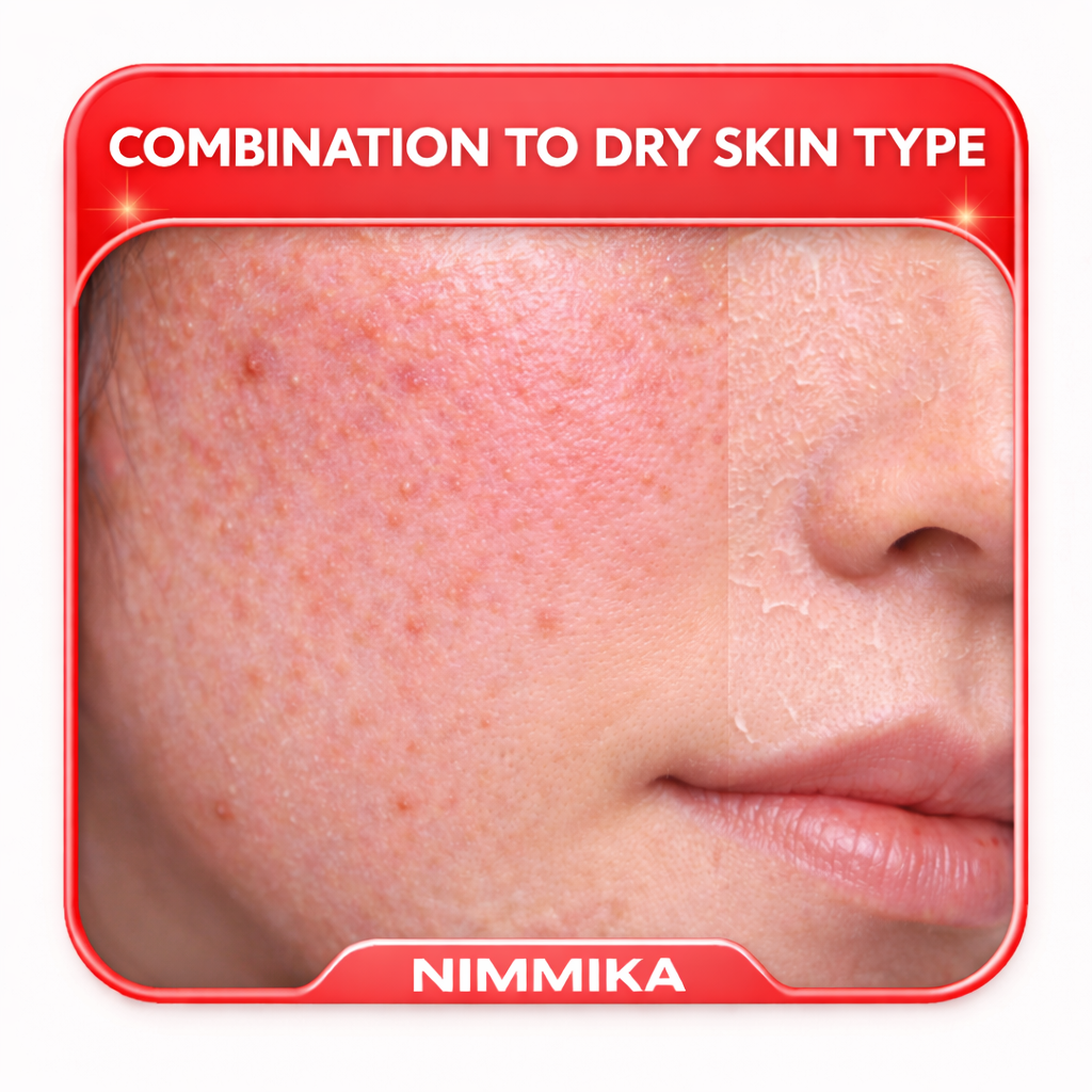 Combination to Dry Skin